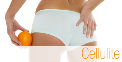 Anti-cellulite, tous nos compléments minceur de marque pas chers.
